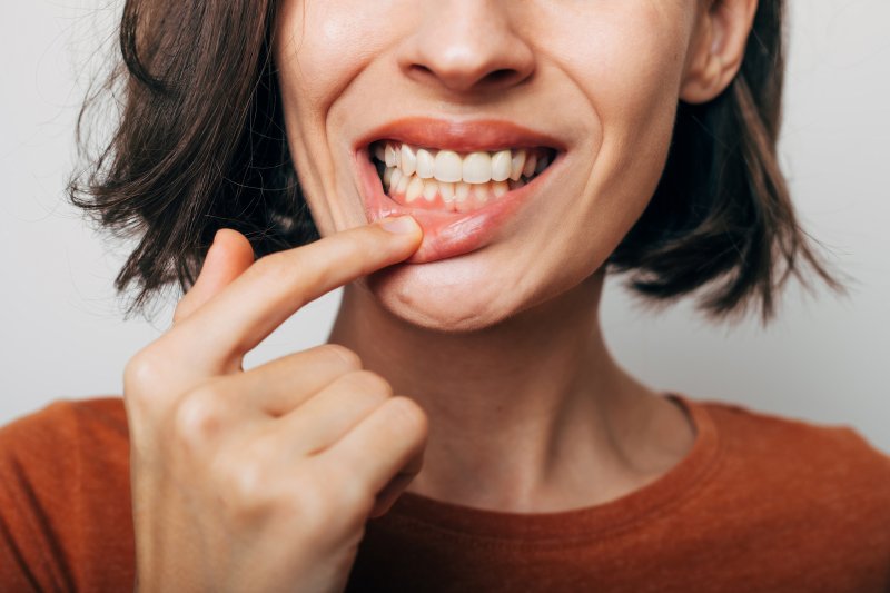 Lady shows her gums