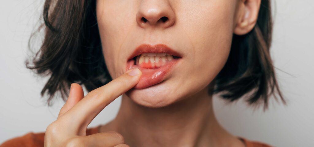 Woman pointing to her gums